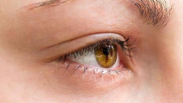 Von wegen harmlos: Ein zuckendes Auge kann Warnsignal für ernste Krankheiten sein
